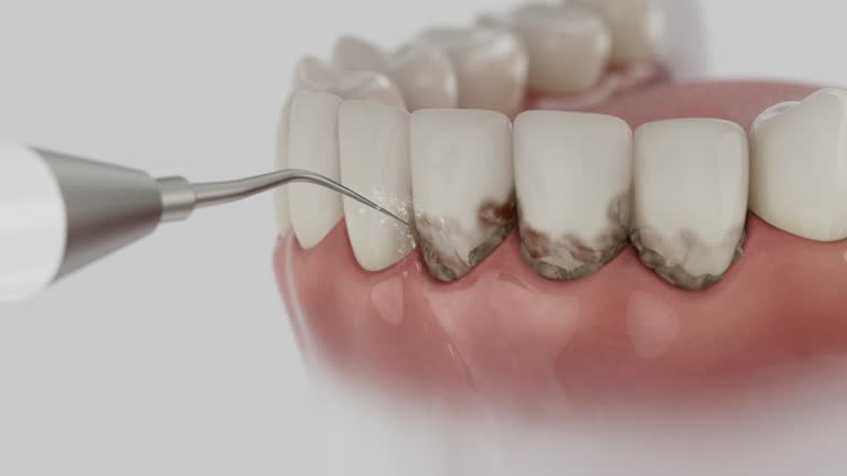 Reliable Emergency Dentist contractor in Setauket, NY by Smile Center Dentistry